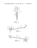 CANTILEVER ARM FOR ORTHODONTIC ANCHORAGE diagram and image