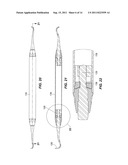 DENTAL HANDPIECE SYSTEM WITH REPLACEABLE TREATMENT TIPS diagram and image