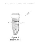 FIXTURE OF DENTAL IMPLANT AND METHOD OF MANUFACTURING THE SAME diagram and image