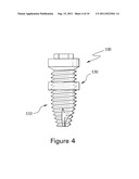 FIXTURE OF DENTAL IMPLANT AND METHOD OF MANUFACTURING THE SAME diagram and image