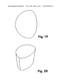 Dental Implant diagram and image