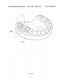 Moldable resin for dental use diagram and image