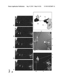 METHOD FOR DIAGNOSING NON-SMALL CELL LUNG CANCER diagram and image