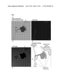 METHOD FOR DIAGNOSING NON-SMALL CELL LUNG CANCER diagram and image