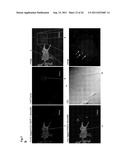 METHOD FOR DIAGNOSING NON-SMALL CELL LUNG CANCER diagram and image