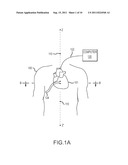 CARDIAC NAVIGATION SYSTEM INCLUDING ELECTRODE ARRAY FOR USE THEREWITH diagram and image