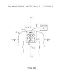 CARDIAC NAVIGATION SYSTEM INCLUDING ELECTRODE ARRAY FOR USE THEREWITH diagram and image