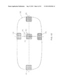 CARDIAC NAVIGATION SYSTEM INCLUDING ELECTRODE ARRAY FOR USE THEREWITH diagram and image