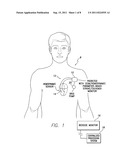 Systems and Methods for Use By an Implantable Medical Device for Detecting     and Discriminating Stroke and Cardiac Ischemia Using Electrocardiac     Signals and Hemodynamic Parameters diagram and image