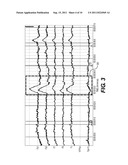 METHOD AND DEVICE FOR REMOVING EEG ARTIFACTS diagram and image