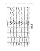 METHOD AND DEVICE FOR REMOVING EEG ARTIFACTS diagram and image