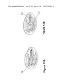 INFUSION SET OF SELF-OCCLUSION MECHANISM diagram and image