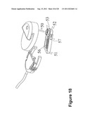 INFUSION SET OF SELF-OCCLUSION MECHANISM diagram and image