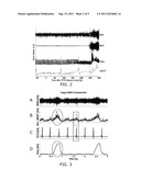 CARDIAC RELATED NEURAL ACTIVITY diagram and image