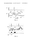 CARDIAC RELATED NEURAL ACTIVITY diagram and image