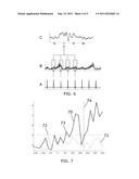 CARDIAC RELATED NEURAL ACTIVITY diagram and image