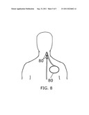 CARDIAC RELATED NEURAL ACTIVITY diagram and image