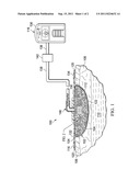 RADIO OPAQUE, REDUCED-PRESSURE MANIFOLDS, SYSTEMS, AND METHODS diagram and image