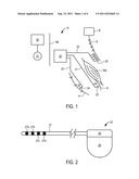 MODULAR STIMULATOR FOR TREATMENT OF BACK PAIN, IMPLANTABLE RF ABLATION     SYSTEM AND METHODS OF USE diagram and image