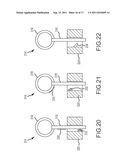 Method and System for  Ligating a Body Part diagram and image