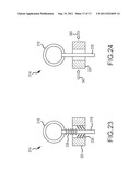 Method and System for  Ligating a Body Part diagram and image