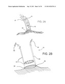 DEVICES, SYSTEMS, AND METHODS FOR CLOSING A HOLE IN CARDIAC TISSUE diagram and image