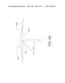 DEVICES, SYSTEMS, AND METHODS FOR CLOSING A HOLE IN CARDIAC TISSUE diagram and image