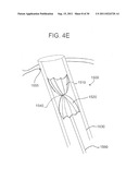 DEVICES, SYSTEMS, AND METHODS FOR CLOSING A HOLE IN CARDIAC TISSUE diagram and image