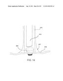 DEVICES, SYSTEMS, AND METHODS FOR CLOSING A HOLE IN CARDIAC TISSUE diagram and image