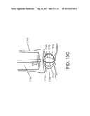 DEVICES, SYSTEMS, AND METHODS FOR CLOSING A HOLE IN CARDIAC TISSUE diagram and image