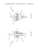 DEVICES, SYSTEMS, AND METHODS FOR CLOSING A HOLE IN CARDIAC TISSUE diagram and image