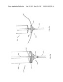 DEVICES, SYSTEMS, AND METHODS FOR CLOSING A HOLE IN CARDIAC TISSUE diagram and image