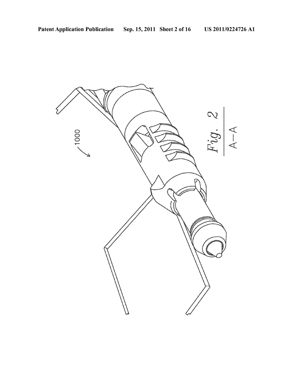 SUTURE ANCHOR - diagram, schematic, and image 03