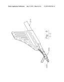 SUTURE ANCHOR diagram and image