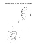 CLOSURE SYSTEM AND USES THEREOF diagram and image