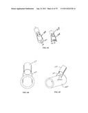 CLOSURE SYSTEM AND USES THEREOF diagram and image