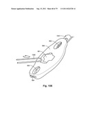 CLOSURE SYSTEM AND USES THEREOF diagram and image