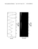 INTRACARDIAC ELECTROGRAM TIME FREQUENCY NOISE DETECTION diagram and image