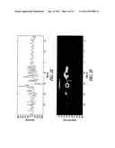 INTRACARDIAC ELECTROGRAM TIME FREQUENCY NOISE DETECTION diagram and image