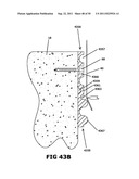 BUILDING CONSTRUCTION WRAPPED WITH REINFORCEMENT FABRIC TO RESIST WIND     LOADING diagram and image