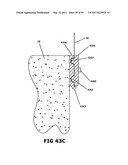 BUILDING CONSTRUCTION WRAPPED WITH REINFORCEMENT FABRIC TO RESIST WIND     LOADING diagram and image