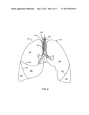 IMPLANTED BRONCHIAL ISOLATION DEVICES AND METHODS diagram and image