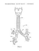 IMPLANTED BRONCHIAL ISOLATION DEVICES AND METHODS diagram and image