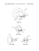 IMPLANTED BRONCHIAL ISOLATION DEVICES AND METHODS diagram and image