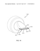 IMPLANTED BRONCHIAL ISOLATION DEVICES AND METHODS diagram and image