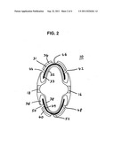 Apparatus for reducing snoring diagram and image