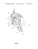 SYSTEMS AND METHODS FOR TREATMENT OF SLEEP APNEA diagram and image