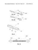 SYSTEMS AND METHODS FOR TREATMENT OF SLEEP APNEA diagram and image