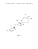 SYSTEMS AND METHODS FOR TREATMENT OF SLEEP APNEA diagram and image