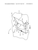 Deployable Aerodynamic Devices with Reduced Actuator Loads diagram and image